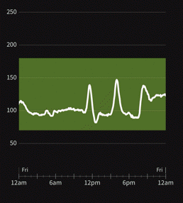 Glucose Intolerance & Spikes